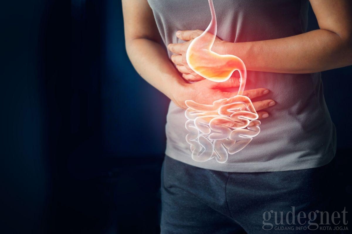 Tips Menjalankan Ibadah Puasa untuk Penderita GERD